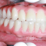 Smiling man after dental implant procedure