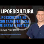 Liposuction Consultation