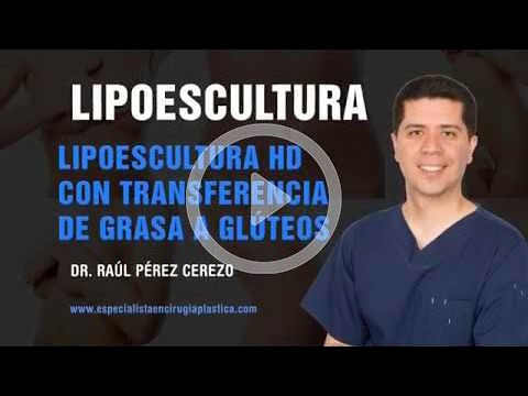 Liposuction Consultation