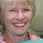 Smiling woman after cosmetic dentistry in Mexico