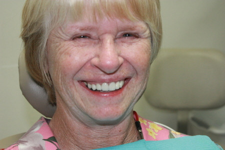 Smiling woman after cosmetic dentistry in Mexico