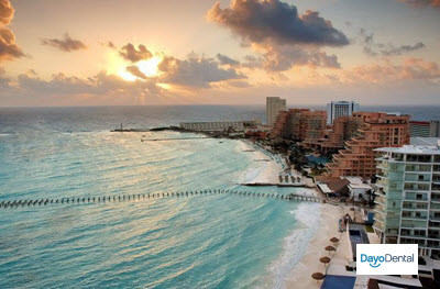 Dental Implants in Mexico Cancun dental trip